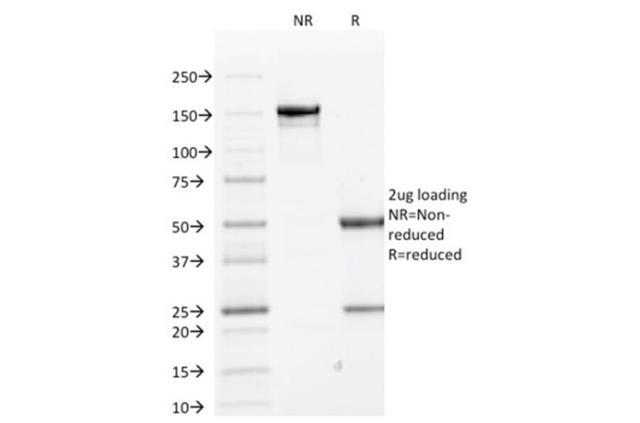 SDS-PAGE - Anti-Cytokeratin 1 Antibody [KRT1/1840] - BSA and Azide free (A252300) - Antibodies.com
