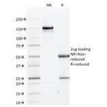 SDS-PAGE - Anti-Cytokeratin 1 Antibody [KRT1/1840] - BSA and Azide free (A252300) - Antibodies.com