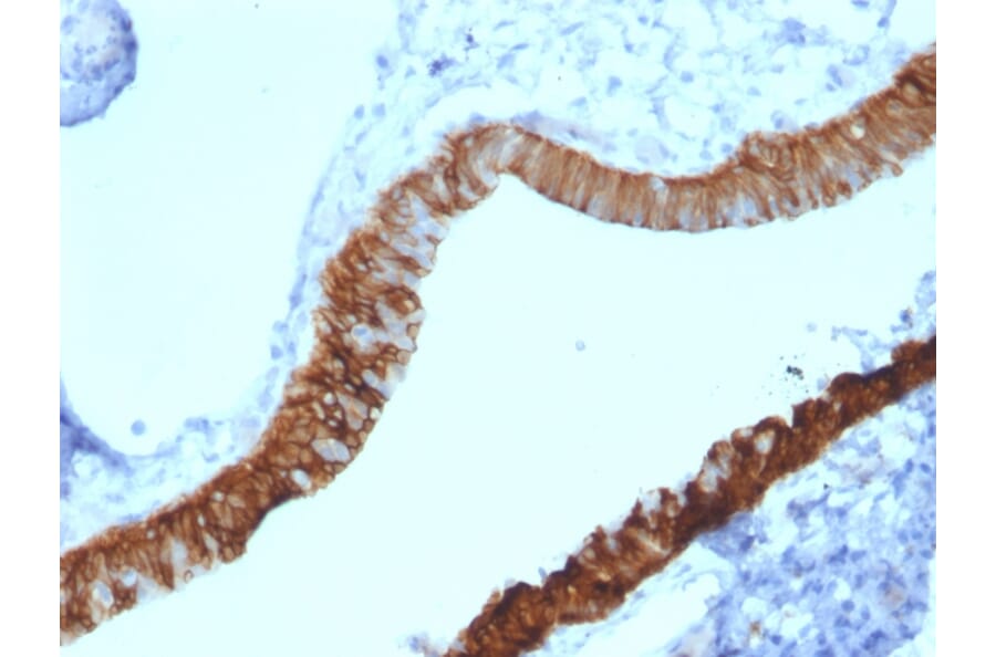 Immunohistochemistry - Anti-Cytokeratin 3 Antibody [KRT3/2130] - BSA and Azide free (A252301) - Antibodies.com
