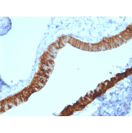 Immunohistochemistry - Anti-Cytokeratin 3 Antibody [KRT3/2130] - BSA and Azide free (A252301) - Antibodies.com