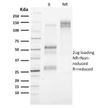 SDS-PAGE - Anti-Cytokeratin 3 Antibody [KRT3/2130] - BSA and Azide free (A252301) - Antibodies.com