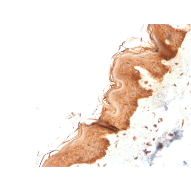 Immunohistochemistry - Anti-Cytokeratin 4 Antibody [KRT4/2804] - BSA and Azide free (A252303) - Antibodies.com