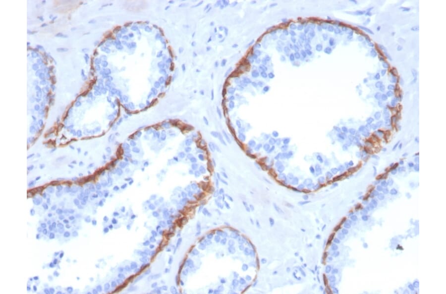 Immunohistochemistry - Anti-Cytokeratin 5 Antibody [KRT5/3594] - BSA and Azide free (A252304) - Antibodies.com