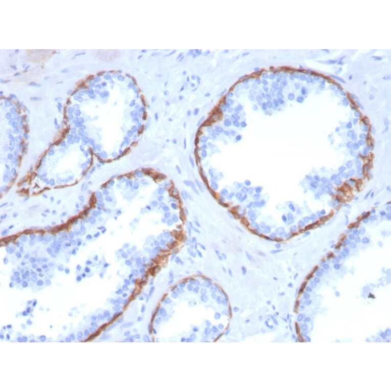Immunohistochemistry - Anti-Cytokeratin 5 Antibody [KRT5/3594] - BSA and Azide free (A252304) - Antibodies.com