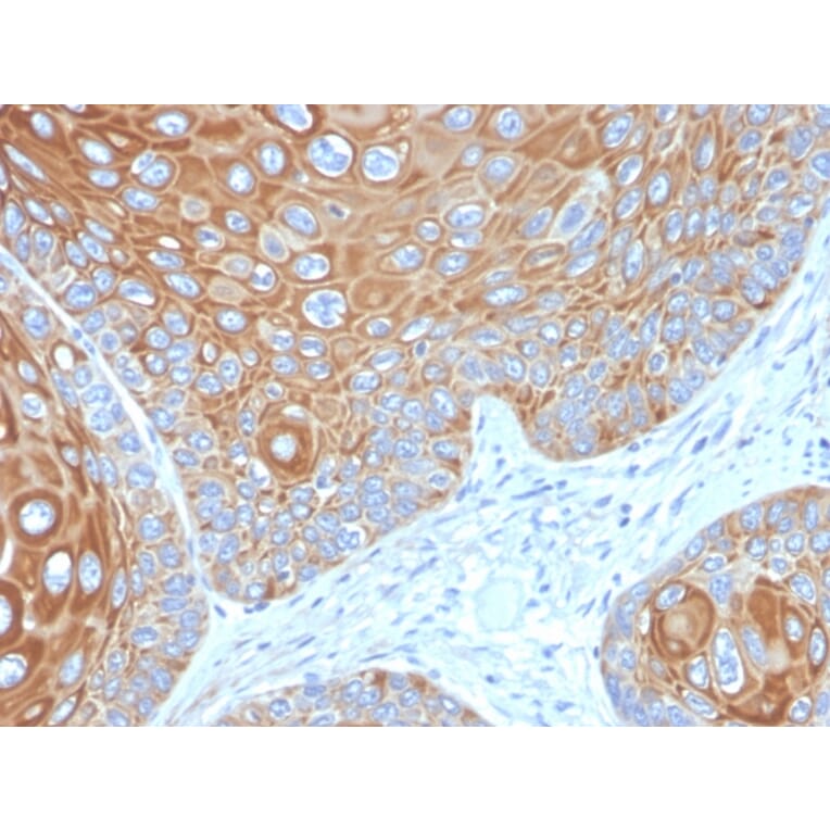 Immunohistochemistry - Anti-Cytokeratin 5 Antibody [KRT5/3594] - BSA and Azide free (A252304) - Antibodies.com