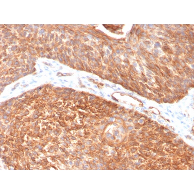 Immunohistochemistry - Anti-Cytokeratin 5 Antibody [KRT5/3594] - BSA and Azide free (A252304) - Antibodies.com
