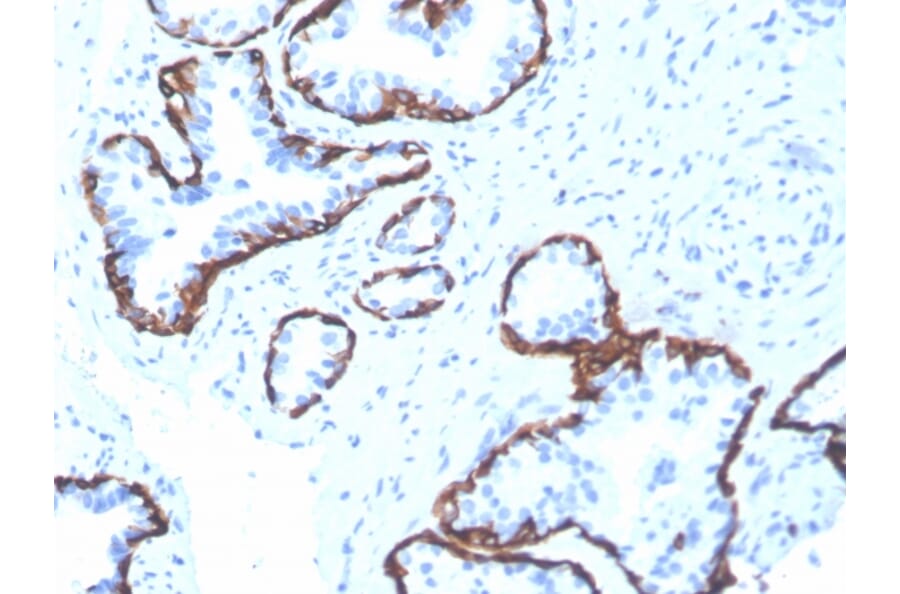 Immunohistochemistry - Anti-Cytokeratin 5 Antibody [rKRT5/6398] - BSA and Azide free (A252305) - Antibodies.com