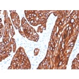 Immunohistochemistry - Anti-Cytokeratin 5 Antibody [rKRT5/6398] - BSA and Azide free (A252305) - Antibodies.com