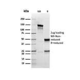 SDS-PAGE - Anti-Cytokeratin 5 Antibody [rKRT5/6398] - BSA and Azide free (A252305) - Antibodies.com