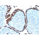 Immunohistochemistry - Anti-Cytokeratin 5 Antibody [KRT5/4245R] - BSA and Azide free (A252306) - Antibodies.com