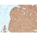 Immunohistochemistry - Anti-Cytokeratin 5 Antibody [KRT5/4245R] - BSA and Azide free (A252305) - Antibodies.com