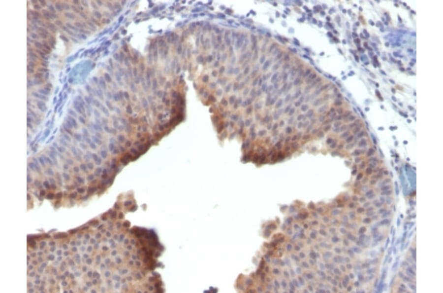 Immunohistochemistry - Anti-Cytokeratin 6 Antibody [LHK6] - BSA and Azide free (A252306) - Antibodies.com