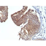 Immunohistochemistry - Anti-Cytokeratin 6 Antibody [KRT6/1702] - BSA and Azide free (A252308) - Antibodies.com