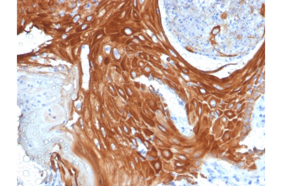 Immunohistochemistry - Anti-Cytokeratin 6A Antibody [KRT6A/2368] - BSA and Azide free (A252310) - Antibodies.com
