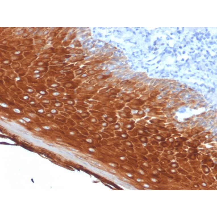 Immunohistochemistry - Anti-Cytokeratin 6A Antibody [KRT6A/2368] - BSA and Azide free (A252310) - Antibodies.com