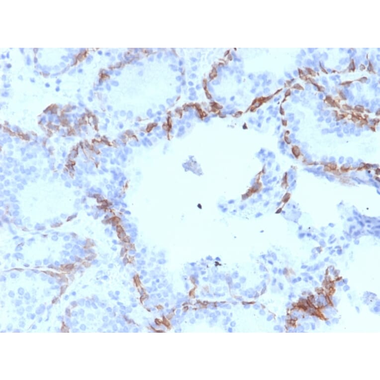 Immunohistochemistry - Anti-Cytokeratin 6A Antibody [KRT6A/2368] - BSA and Azide free (A252310) - Antibodies.com