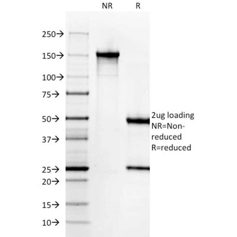 SDS-PAGE - Anti-Cytokeratin 6A Antibody [KRT6A/2368] - BSA and Azide free (A252310) - Antibodies.com