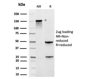 SDS-PAGE - Anti-Cytokeratin 6A Antibody [rKRT6A/2100] - BSA and Azide free (A252311) - Antibodies.com