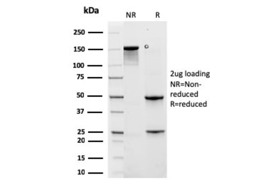 SDS-PAGE - Anti-Cytokeratin 6A Antibody [rKRT6A/2100] - BSA and Azide free (A252311) - Antibodies.com