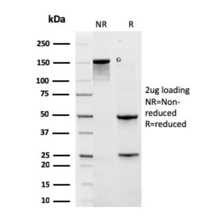 SDS-PAGE - Anti-Cytokeratin 6A Antibody [rKRT6A/2100] - BSA and Azide free (A252311) - Antibodies.com