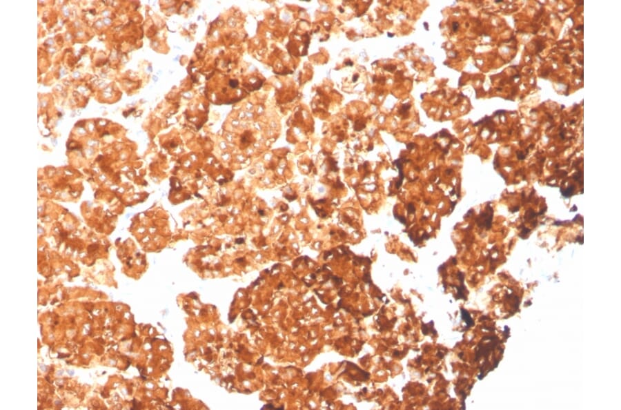 Immunohistochemistry - Anti-Cytokeratin 6A Antibody [rKRT6A/2100] - BSA and Azide free (A252310) - Antibodies.com