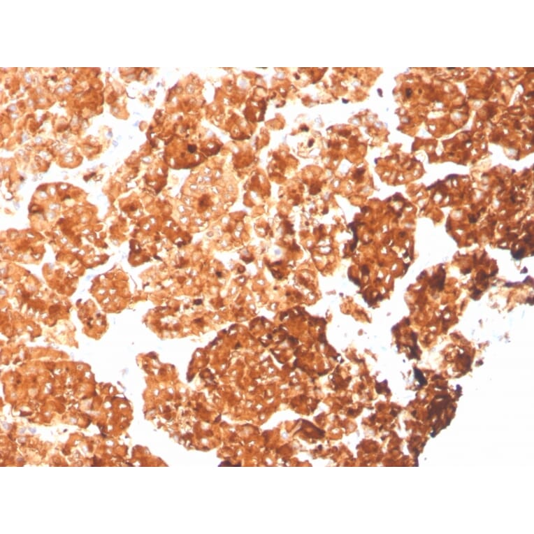 Immunohistochemistry - Anti-Cytokeratin 6A Antibody [rKRT6A/2100] - BSA and Azide free (A252310) - Antibodies.com