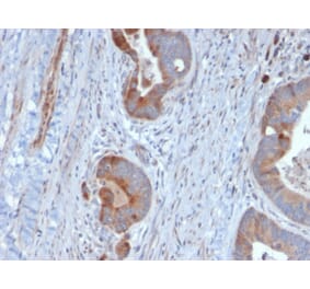 Immunohistochemistry - Anti-Cytokeratin 6B Antibody [KRT6B/2116] - BSA and Azide free (A252312) - Antibodies.com