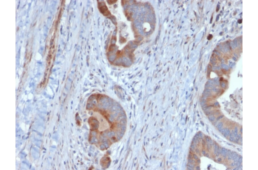 Immunohistochemistry - Anti-Cytokeratin 6B Antibody [KRT6B/2116] - BSA and Azide free (A252312) - Antibodies.com