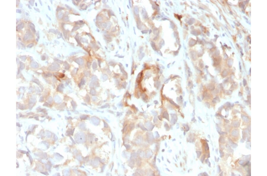 Immunohistochemistry - Anti-Cytokeratin 6B Antibody [KRT6B/2116] - BSA and Azide free (A252311) - Antibodies.com