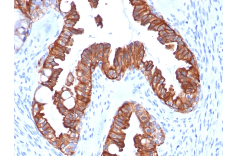 Immunohistochemistry - Anti-Cytokeratin 7 Antibody [rOV-TL12/30] - BSA and Azide free (A252313) - Antibodies.com