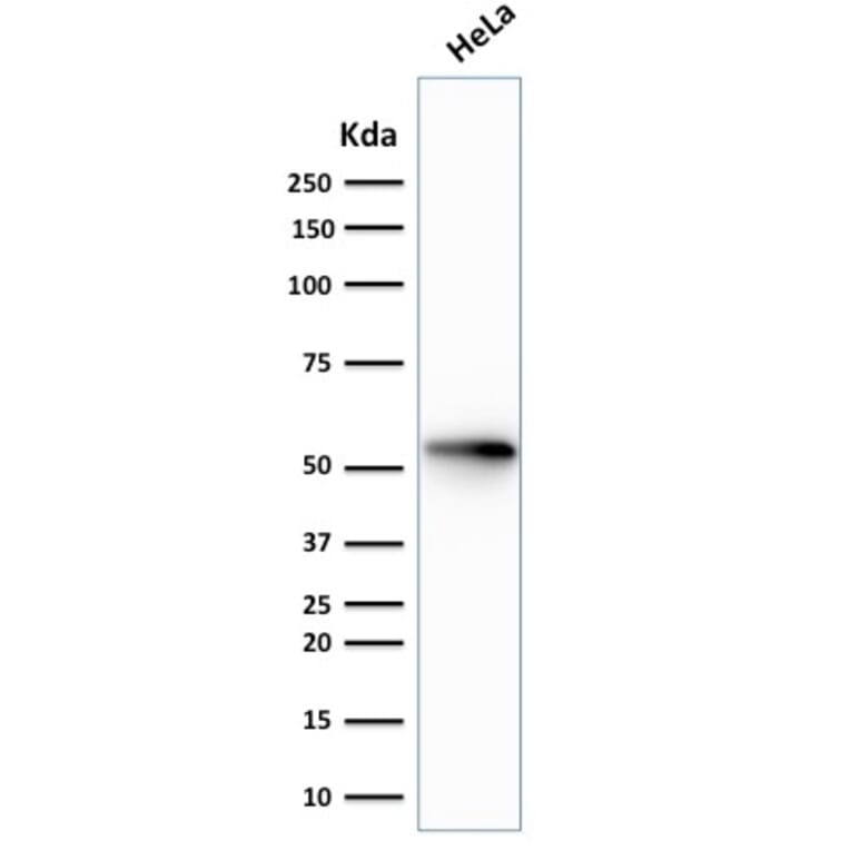 Western Blot - Anti-Cytokeratin 7 Antibody [rOV-TL12/30] - BSA and Azide free (A252313) - Antibodies.com