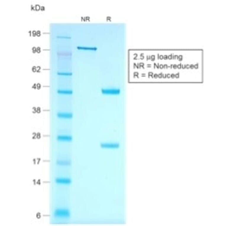 SDS-PAGE - Anti-Cytokeratin 7 Antibody [rOV-TL12/30] - BSA and Azide free (A252313) - Antibodies.com