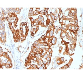 Immunohistochemistry - Anti-Cytokeratin 7 Antibody [KRT7/2200] - BSA and Azide free (A252314) - Antibodies.com