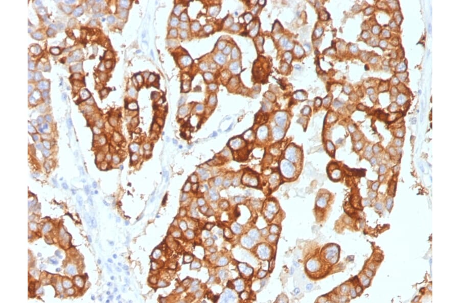 Immunohistochemistry - Anti-Cytokeratin 7 Antibody [KRT7/2200] - BSA and Azide free (A252314) - Antibodies.com