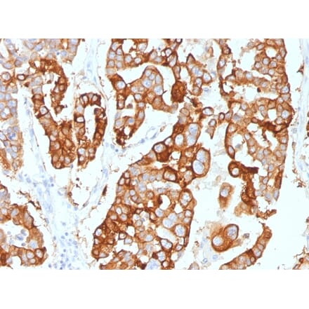 Immunohistochemistry - Anti-Cytokeratin 7 Antibody [KRT7/2200] - BSA and Azide free (A252314) - Antibodies.com