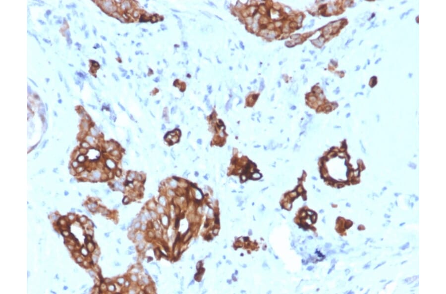 Immunohistochemistry - Anti-Cytokeratin 7 Antibody [KRT7/2200] - BSA and Azide free (A252313) - Antibodies.com
