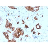 Immunohistochemistry - Anti-Cytokeratin 7 Antibody [KRT7/2200] - BSA and Azide free (A252313) - Antibodies.com