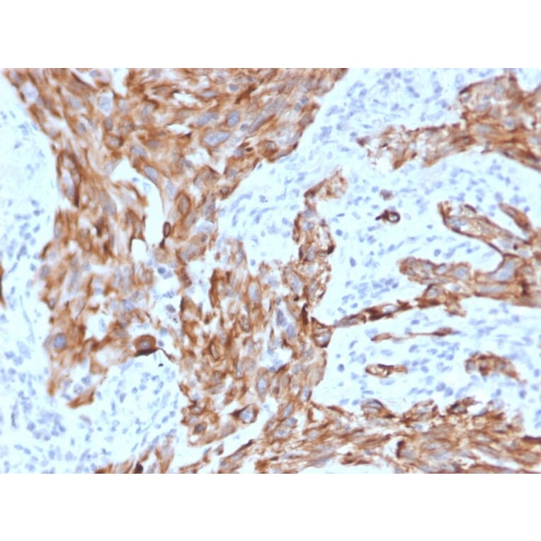 Immunohistochemistry - Anti-Cytokeratin 7 Antibody [KRT7/2200] - BSA and Azide free (A252314) - Antibodies.com