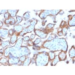 Immunohistochemistry - Anti-Cytokeratin 7 Antibody [KRT7/2200] - BSA and Azide free (A252314) - Antibodies.com