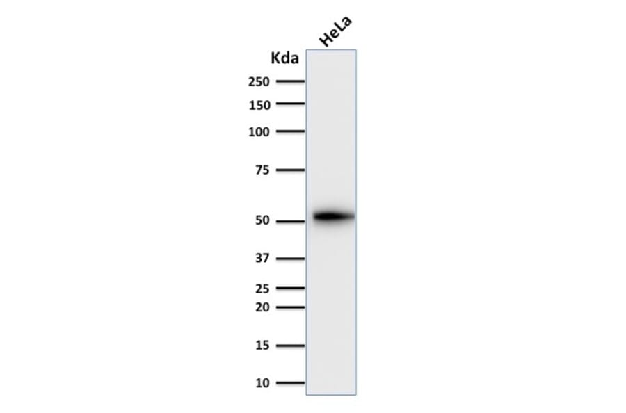 Western Blot - Anti-Cytokeratin 7 Antibody [KRT7/2200] - BSA and Azide free (A252314) - Antibodies.com