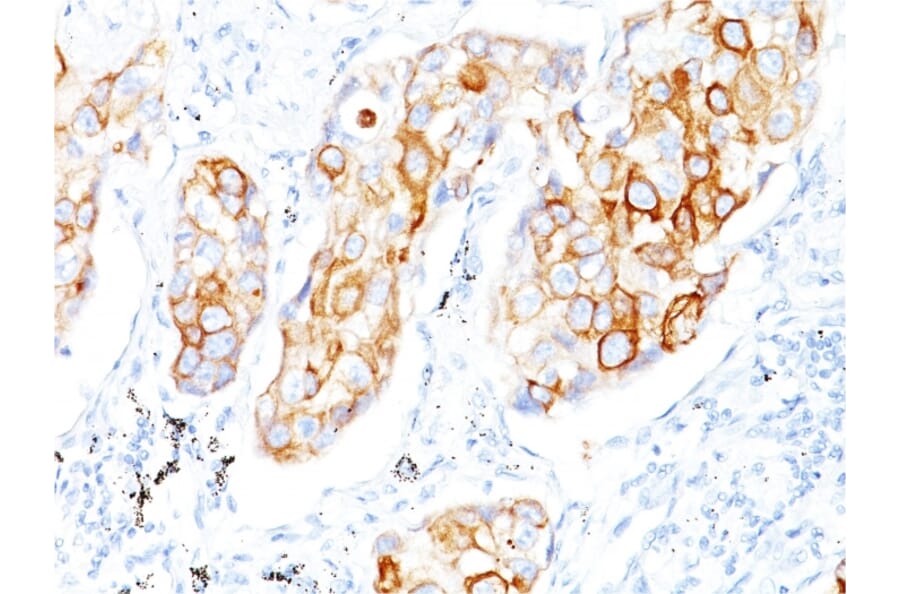 Immunohistochemistry - Anti-Cytokeratin 7 Antibody [OV-TL12/30] - BSA and Azide free (A252315) - Antibodies.com