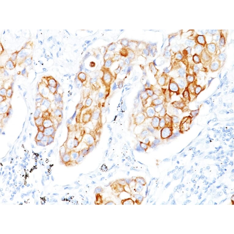 Immunohistochemistry - Anti-Cytokeratin 7 Antibody [OV-TL12/30] - BSA and Azide free (A252315) - Antibodies.com