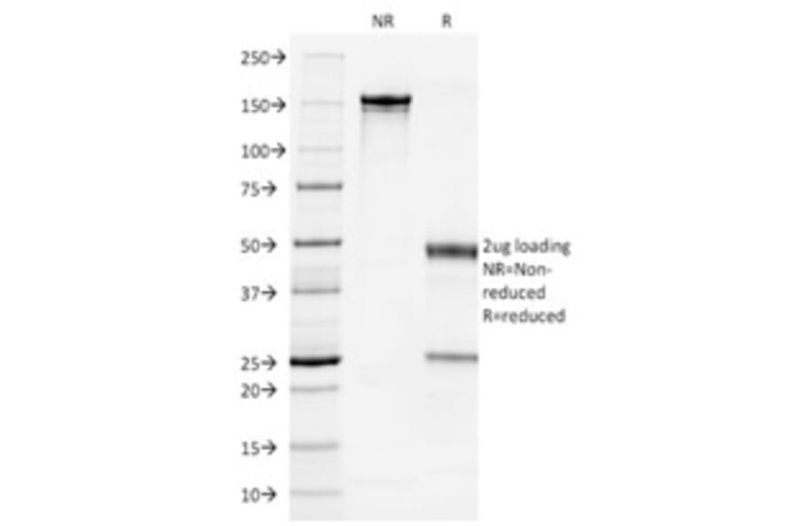 SDS-PAGE - Anti-Cytokeratin 7 Antibody [OV-TL12/30] - BSA and Azide free (A252315) - Antibodies.com