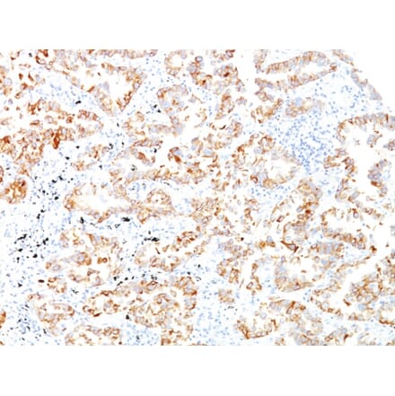 Immunohistochemistry - Anti-Cytokeratin 7 Antibody [SPM270] - BSA and Azide free (A252316) - Antibodies.com