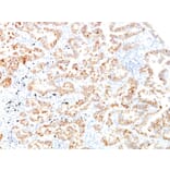 Immunohistochemistry - Anti-Cytokeratin 7 Antibody [SPM270] - BSA and Azide free (A252316) - Antibodies.com