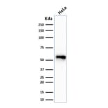 Western Blot - Anti-Cytokeratin 7 Antibody [SPM270] - BSA and Azide free (A252316) - Antibodies.com