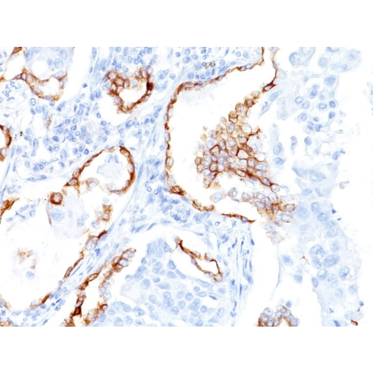 Immunohistochemistry - Anti-Cytokeratin 7 Antibody [K72.7] - BSA and Azide free (A252317) - Antibodies.com