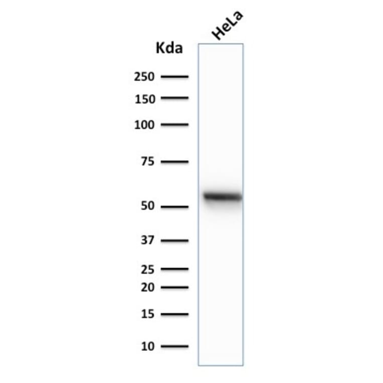 Western Blot - Anti-Cytokeratin 7 Antibody [K72.7] - BSA and Azide free (A252317) - Antibodies.com