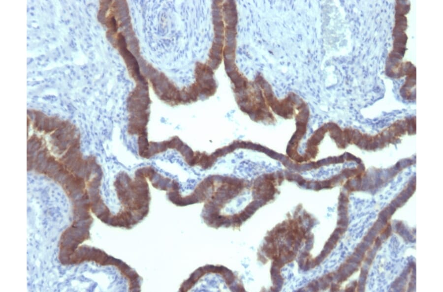 Immunohistochemistry - Anti-Cytokeratin 7 Antibody [KRT7/903] - BSA and Azide free (A252318) - Antibodies.com
