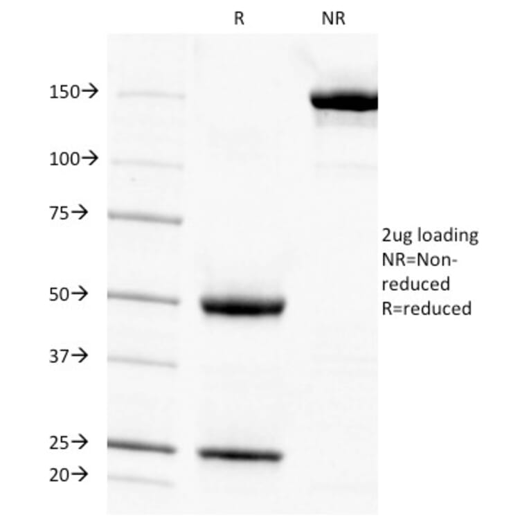 SDS-PAGE - Anti-Cytokeratin 7 Antibody [KRT7/903] - BSA and Azide free (A252318) - Antibodies.com